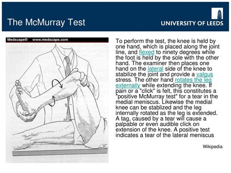 mcmurray compression test|mcmurray test results.